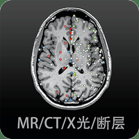 影像解剖图谱免费会员版