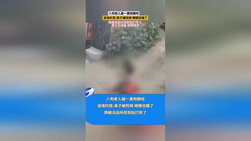 山东菏泽八旬老人遭恶犬撕咬致重残：鼻子被咬掉，眼睛也瞎了