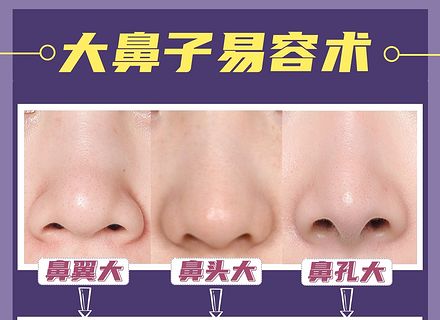 3种类型大鼻子有效修饰技巧