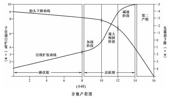 分娩产程图