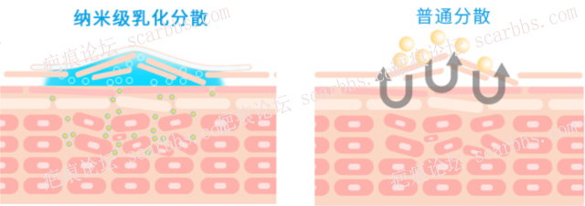 硅酮真的能抑制疤痕吗？ 