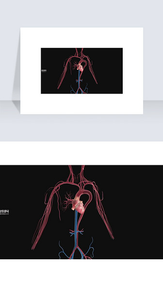 3D医疗视频心脏支架特效截图