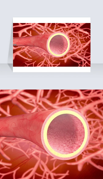 3D医疗视频血管红色毛细血管截图