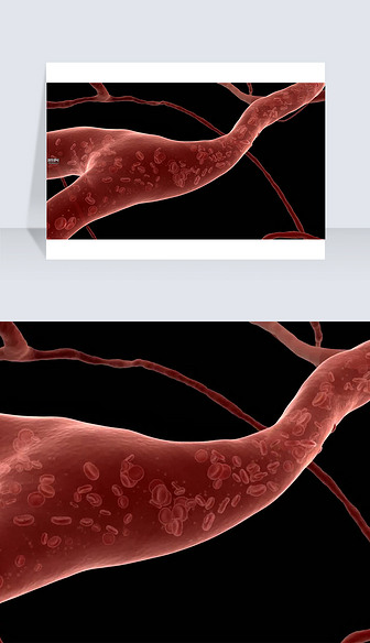 3D医疗视频血管备注流动截图