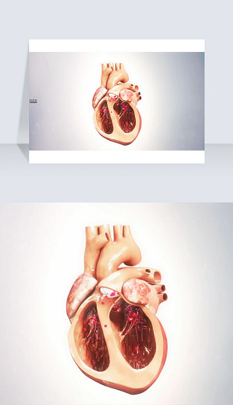 3D医疗视频截图心脏剖面