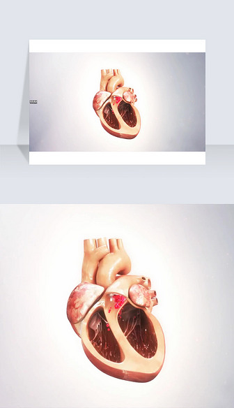 3D医疗视频截图心脏剖面