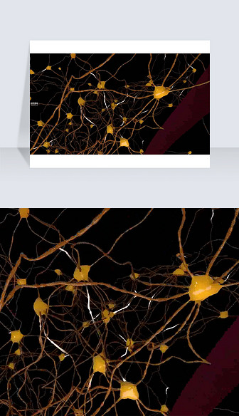 3D医疗视频截图神经系统血管和神经元