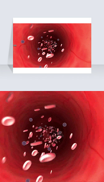 3D医疗视频截图病变渗入血管随血液流动