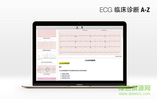 ECG临床诊断mac版 v1.0 苹果电脑版 0