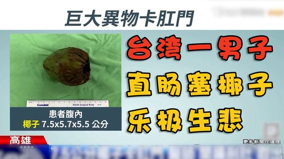台湾男子直肠塞椰子，导致腹痛不止，无奈求助医生只能剖腹产取出