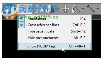 RadiAnt DICOM Viewer(图片浏览) 1.1.8 官方版