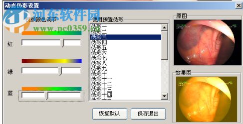 内窥镜影像工作站 13.2 官方版