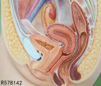 输卵管双侧积水可以怀孕吗