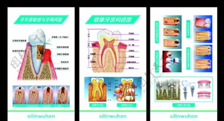 牙齿构造图