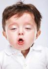三岁小儿反复咳嗽一月治疗方法